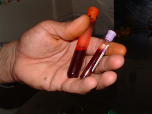 Limited blood tests are conducted at the end of a feeding trial.